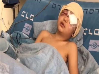 فلسطين تندد بجريمة الاحتلال بحق «الطفل عيسى» وتطالب برفعها للمحاكم الدولية