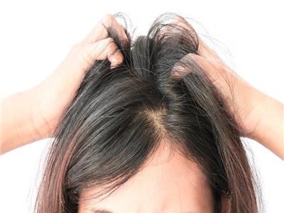 هل عملية زراعة الشعر تسبب السرطان؟ طبيب يجيب