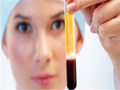 "جراح تجميل" يكشف تفاصيل فصل البلازما عن الدم لعلاج مشاكل الشعر   