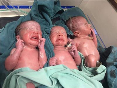صور | ولادة ٣ توائم بمستشفى الأقصر العام