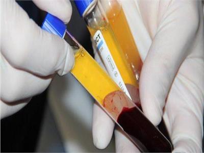 «الصحة» تكشف عن فوائد واستخدامات بلازما الدم