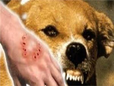غالبًا ما يسبّب الوفاة.. إجراءات عليك اتباعها إذا تعرضت لـ«عضة الكلب»