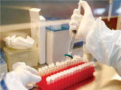 روسيا تسجل نظام اختبار للكشف عن سلالات مختلفة من فيروس «كورونا»