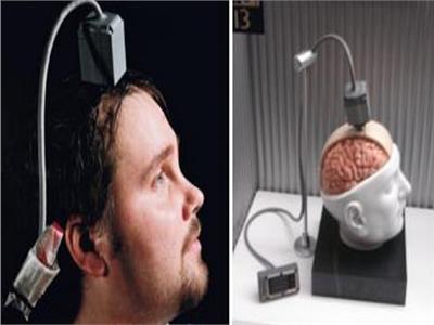 ابتكار أول جهاز يتيح للمصابين بالشلل استخدام الحاسوب بعقولهم | صور 