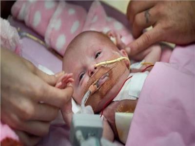 بـ«3 أعضاء تناسلية» أغرب ولادة في العالم لطفل عراقي  