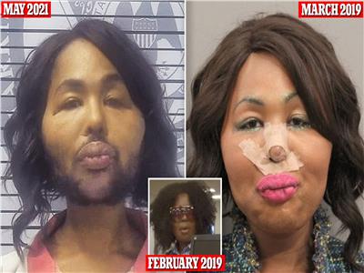 متحولة جنسياً تسرق مصرف بنكي من أجل عمليات التجميل
