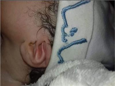 ولادة طفلة جزائرية محفور على أذنها اسم «الله» | فيديو