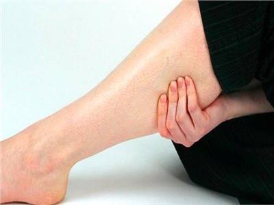 جلطة الساق.. الأعراض وطرق الوقاية