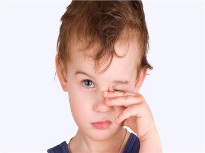 ٤ أسباب وراء إحمرار العين عند الرضع