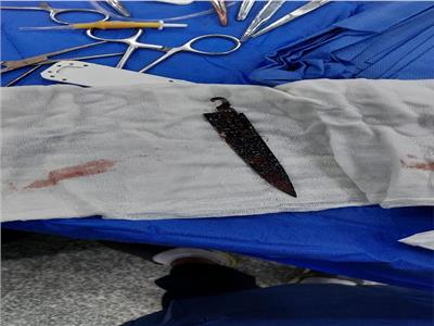 فريق طبي ينجح فى إخراج سكين اخترقت صدر مريض في السويس