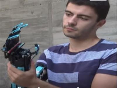 «بذراع روبوتية».. شاب يتحدى إعاقته ويدخل العالمية | فيديو