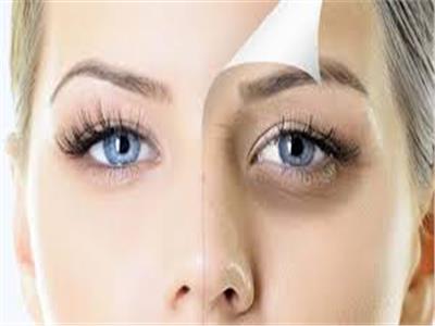 وصفات طبيعية لعلاج مشاكل العينين وإبراز جمالها