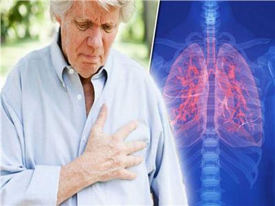 «دراسة»: التدخين السبب الأكثر شيوعا في سرطان الرئة