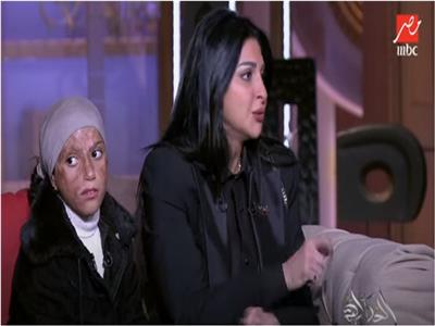 هبة السويدي: نحتاج لتجهيز 10 غرف عناية بمستشفى أهل مصر لضحايا الحروق 