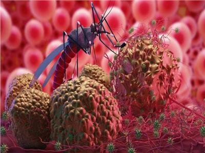 اليوم العالمي للملاريا 2022: كيف تفرق بين  Covid-19 و الملاريا