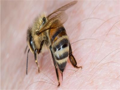 البحوث الزراعية: الحساسية المفرطة سبب الوفاة بلدغة النحل | فيديو