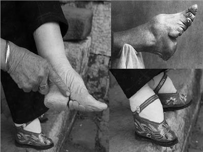 عادات الصينيين في القرن العشرين.. ضفائر الرجال وأحذية ضيقة للنساء 
