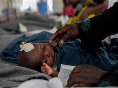 «زيمبابوي» تصرح بإصابة 2056 ووفاة 157 طفلا بالحصبة 