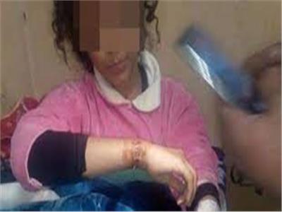 طفلة تتعرض لتعذيب وحشي من والدها وزوجته بـ«بورسعيد»