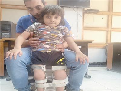 «ماليك» ينتظر طوق النجاة.. طفل حديدي يحتاج عملية نقل أوتار ليقف على قدميه