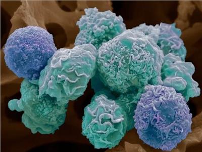 ابتكار جديد يكشف عن 4 سرطانات باختبار واحد