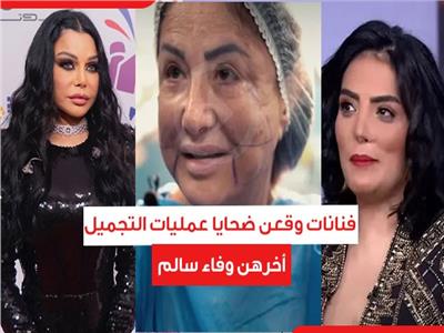 فنانات وقعن ضحايا عمليات التجميل.. أخرهن وفاء سالم | فيديو 