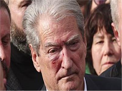 إصابة زعيم المعارضة الألبانية في رأسه خلال احتجاجات مناهضة للحكومة