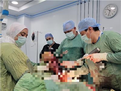  إجراء عمليتين جراحيتين ذات مهارة خاصة بنجاح في مستشفى النوبارية