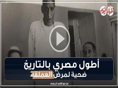 فيديوجراف| أطول مصري بالتاريخ.. ضحية لمرض «العملقة»  