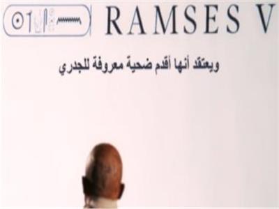 الصحة العالمية: «رمسيس الخامس» أقدم ضحية معروفة لمرض الجدري.. فيديو 