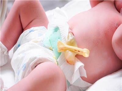 5 خطوات بسيطة للعناية بسرة الطفل حديث الولادة