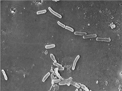 وفاة 4 أشخاص بسبب بكتيريا نادرة نتيجة قطرة عين ملوثة  
