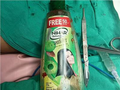 استخراج زجاجة زيت شعر من بطن رجل هندي |صور