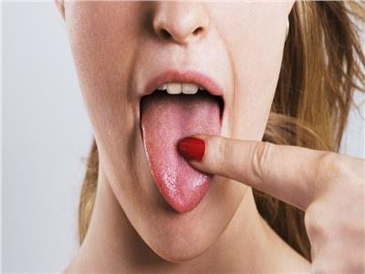 احذر.. «جفاف الفم» ينذرك بأمراض خطيرة
