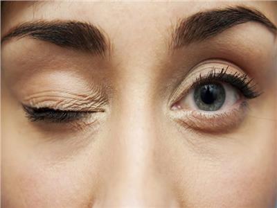 تعرف على أسباب وطرق علاج «نفضة العين»