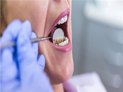 احذر.. أطقم الأسنان غير النظيفة تزيد من خطر الإصابة بهذا المرض