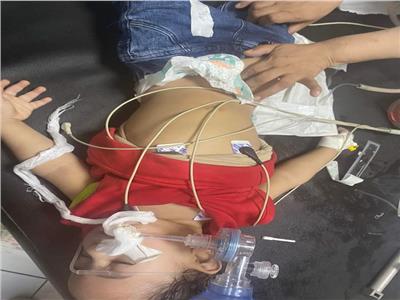 فريق طبي ينجح في إنقاذ طفل رضيع ابتلع جسم غريب بمستشفي كفرالزيات العام