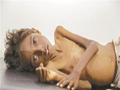 «الأغذية العالمي»: 24 مليون شخص على حافة الجوع