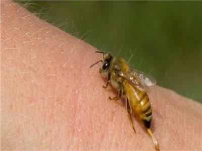تعرف على فوائد لسعات النحل علي الجسم