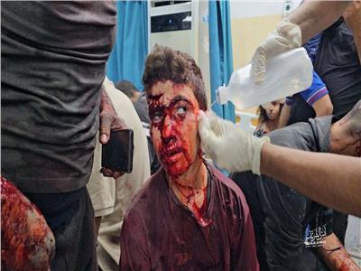 وصول المصابين لمستشفى الأندونيسي بعد القصف الإسرائيلي | صور     