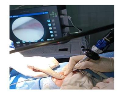 مستشفى سوهاج الجامعي تنجح في إجراء 4 عمليات متخصصة في الوجه والجمجمة