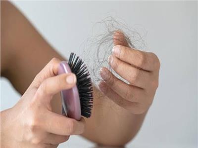 4 أسباب خطيرة تسبب تساقط الشعر