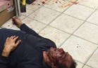 بالفيديو..القصة الكاملة لحادث الاعتداء على مصري بالكويت