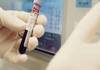 السعودية تعلن عن 11 حالة إصابة بالفيروس التاجي ميرس في جدة