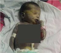 إحالة ٦ متهمين بمستشفى الوراق المركزي للمحاكمة لتسببهم في وفاة طفل حرقا