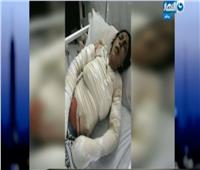 فيديو| تفاصيل مصرع سيدة وجنينها في حريق مستشفى كفر الشيخ