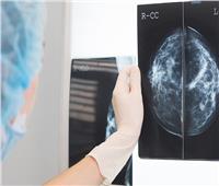 تقنية مذهلة تساعد في تشخيص «سرطان الثدي» 