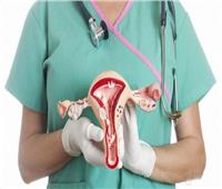 طبيب أمراض نساء يوجه نصيحة لنساء مصر حول زراعة الرحم