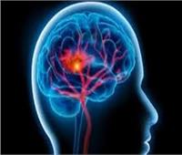 دراسة تشير لارتباط التوتر والصدمة مبكرا بانخفاض حجم منطقة الحصين بالمخ