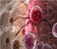 شاهد| جهاز محمول يكشف عن مرض «السرطان» في دقائق 
